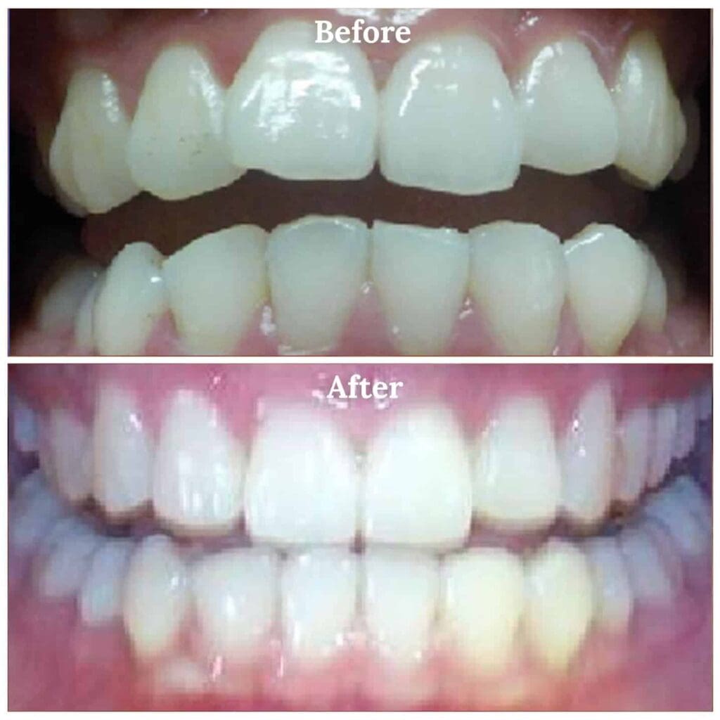 Jailenne teeth