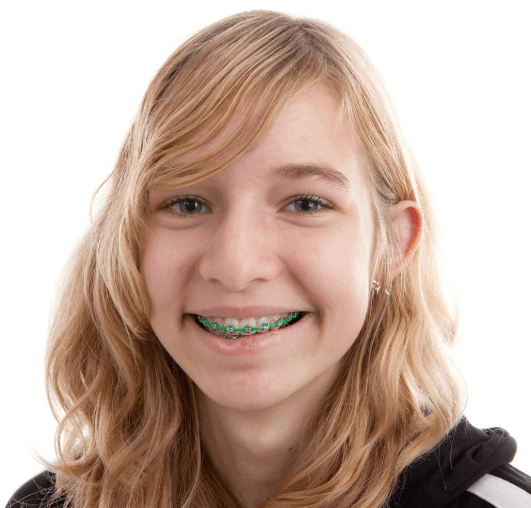 Teen girl smiling with green braces against a white background