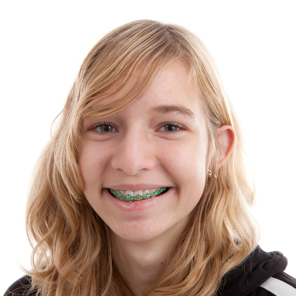 Teen girl smiling with green braces against a white background